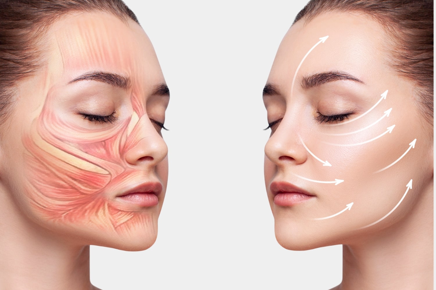 Преимущества СМАС лифтинга методом МЕНДЕЛЬСОНА